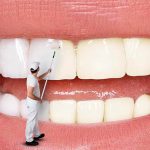 بهترین راه سفید کردن دندان ها در دندانپزشکی