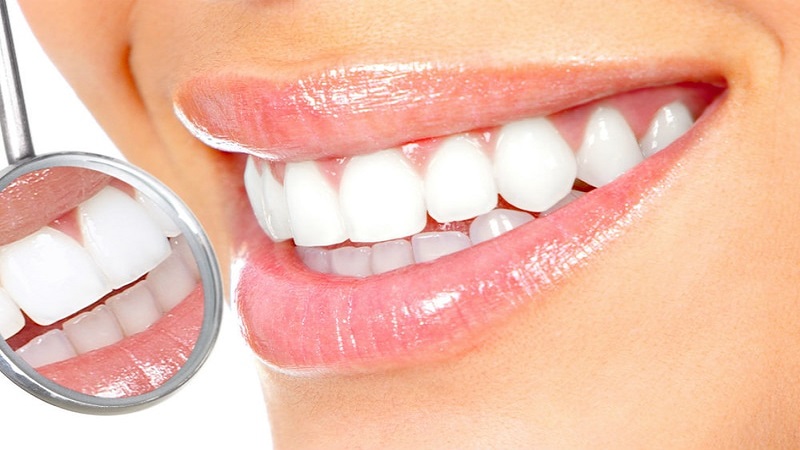 بهترین راه سفید کردن دندان ها در دندانپزشکی